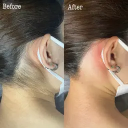 [女性]ワックス　うなじ