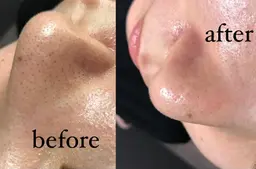 【1月平日ご来店限定】ﾊｲﾄﾞﾗﾌｪｲｼｬﾙ＋ﾊﾟｯｸ🚹🚺