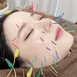 ⚠️平日限定🌈美容鍼🌈鍼(うつ伏せ:頭~足)＋美容鍼(仰向:顔、手足)＋頭皮鍼＋パルス（電気鍼:顔）＋小顔マッサージ