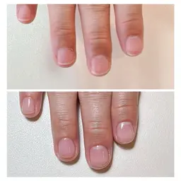 美爪育成の無料相談