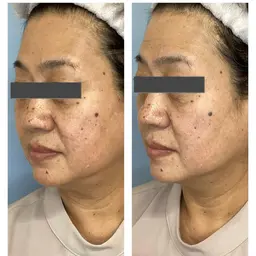 平日minimo限定⭐️むくみ、くすみ改善コース