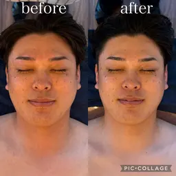 【リピーター様✨】本格的！本場韓国式🇰🇷韓国アイドル必須項目✅小顔筋膜リリースコルギコース💆🏻‍♀️💕