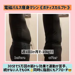 電磁パルス痩身マシン《ボディスカルプト》お試し