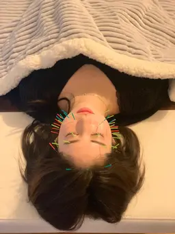 首や頭のコリもスッキリ!小顔になりながらカラダも整えたい方はこちら!自律神経調整+美容鍼+小顔整体フルコース