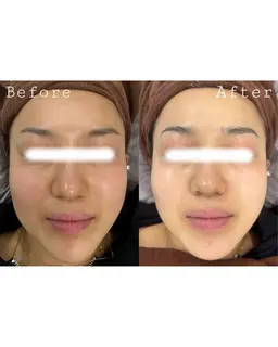 ✨【透明感UP美肌】シミ・くすみ・たるみ改善フェイシャルコース✨