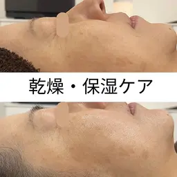 ぷるっとモチ肌【乾燥対策】剥けないハーブピーリング(パワーローズ付き)