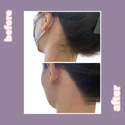 イベント前に大人気☺️🫶【うなじワックス脱毛】そのうなじ、見られてますよ👀シェービング不要でそのまま来店可☺️✨