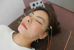 リフトアップ効果抜群◎ 【パルス美容鍼】 30分