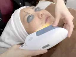 【シミ/肌荒れケア】美白鍼120分⭐️美容鍼とIPLで透明感のある肌へ!