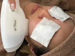 【光脱毛×肌トラブル改善】お化粧のりバッチリ✨顔脱毛✨