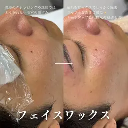 【美肌×清潔感】顔全体ワックス脱毛✨産毛&古い角質オフでワントーン明るい肌へ。保湿ケア付き◎