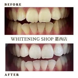 【ミニモ学割U24ホワイトニング】🌸20分×6回照射🌸