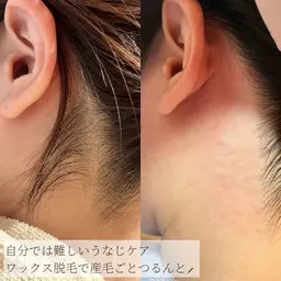 首元すっきり✨うなじワックス【後ろ姿美人に🌿】4500円→4000円