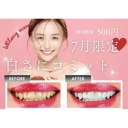 【口コミ投稿でお得☆】セルフホワイトニング(9分2セット)　1回¥3,980→¥500