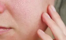 【初回限定】ほっぺに見える「毛穴の開き」専用ケア体験