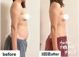 【これが私？！】お腹背中キャビ&バストアップで脂肪デザイン☆上半身美ボディ90分