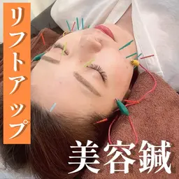 リフトアップ美容鍼🥰【電気美容鍼】が今ならお🉐に受けられます🪄《口コミ投稿で¥500オフ✨️》