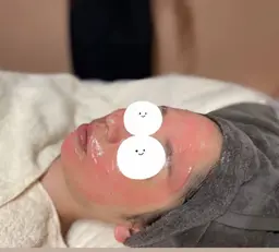 お得💖ミニモ限定 フェイシャルエステ+お肌のお悩み別パック+選べるお化粧品コース✨(マスカラ/まつ毛美容液)