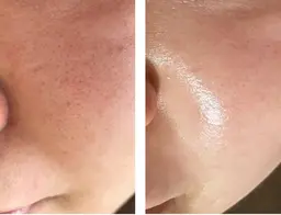 17,880円→9,890円🔥 \口元+フェイシャル+ボディの印象変えたい方🥰/