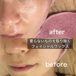 ツヤ、ピカ✨️内側から発光するお肌へ~美肌wax*お写真モデル