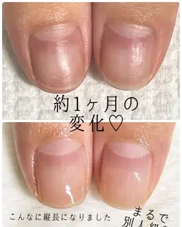 おすすめ‼️お試し美地爪ネイルケア💅ジェルで痛んだ爪にも1回体験🫧