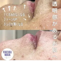 フェイシャルWax