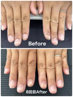 先着2名様限定‼️自爪育成🌱通常コース(全７回)ホームケアセットプレゼント🎁