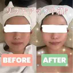 限定🌟ハイドラ・プラズマ・EMSフェイシャルから２種類の組み合わせを選べて、さらに美容液導入付きのコース☆4980円