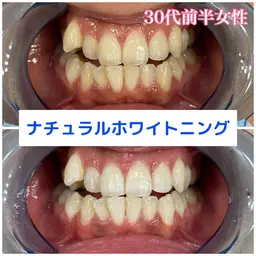 初めの方へオススメ‼️一度で効果を感じたい方へ‼️初回30分照射‼️