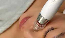 【ごっそり毛穴洗浄】いちご鼻改善！毛穴レスハイドラフェイシャル¥5500