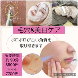 春~夏におすすめ!毛穴&美白ケア