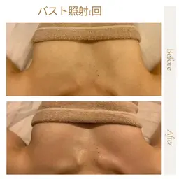 【バストケア】サイズアップ&ハリUP＊バストアップケア¥8000