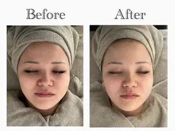 ⭕️半額⭕️(60分)うる艶ジェルパック➕フェイシャルマッサージ【小顔/浮腫み/乾燥/潤い】➕ソフトシェービング産毛ケア