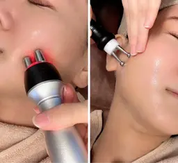 minimo特別🌈ラジオ波＋EMS＋エニシーグローパック💎(炭酸ガスパック)首肩デコルテ+ドライヘッド 80分