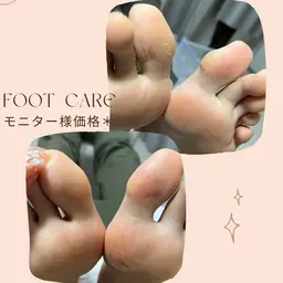 フット角質ケア ＊ ￥3300