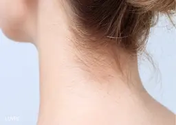 女性限定！WAX脱毛/うなじ