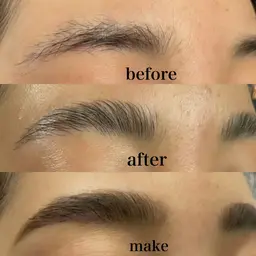 HOLLYWOOD BROW LIFT