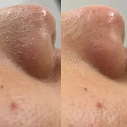 【特別価格】ラッシュリフト＋デザイニングアイブロウ+小鼻ケア（撮影あり）