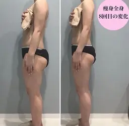 【痩身】【二の腕･脇肉】ブライダルの方にも👰肩​〜​二の腕のドレスラインをガッツリ施術🔥 キャビ/ラジオ波/吸引/EMS