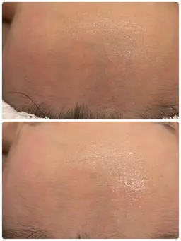 【ゲリラクーポン】12月28・29・30日限定‼️最高級クリーム塗布でお仕上げ✨