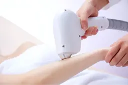 【ミニモ限定】【男性限定】【都度払い】全身脱毛（ヒゲVIOあり）