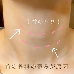 ◆学生限定◆猫背・肩こり・首痛ケア☆骨盤から整える美容整体