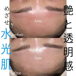 LDMエメ水肌ポレーション(潤艶光フェイシャル+ヘッドマッサージ付)60分