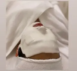 夏におすすめ☀️シミや紫外線ダメージが気になる方に！アドバンスコース+美白パック