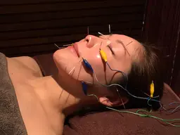 ✨美容鍼 美容灸 美容鍼パルス［写真/動画撮影させて頂く場合あり］✨