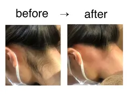 【絶対オススメ！】うなじWAX