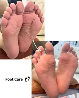 フットケア👣足裏角質除去/ファイリング /甘皮処理👣【練習モニター】 期間限定¥5980→¥1500