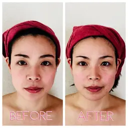 小顔効果抜群❣️ 表情筋小顔リフトアップコース♪フェイスラインすっきり！目ヂカラUP！デコルテ&首肩も。オールハンド施術