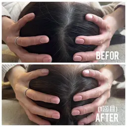 【すぐ効果実感💎】小顔矯正x頭蓋骨矯正フル施術💆‍♀️通常価格22000円 →体験価格 3300円