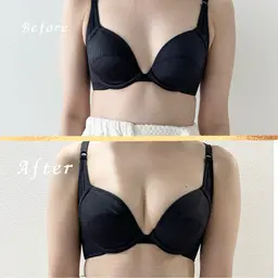 【☆ミニモ限定価格☆顔なし写真モニター様限定！】感動のバストアップ体験！ＮRベルバスト+全身49.800円→4.980円